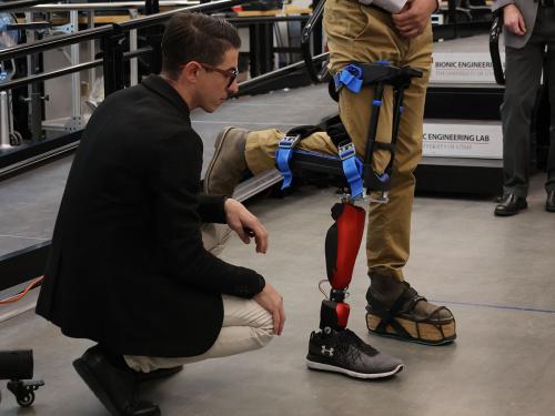 Bionic Leg